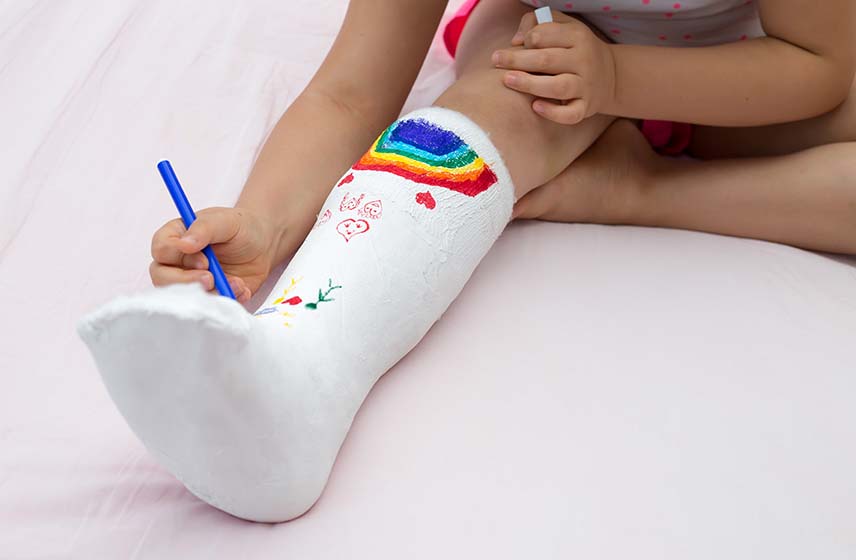儿童病人小腿石膏绘画艺术。