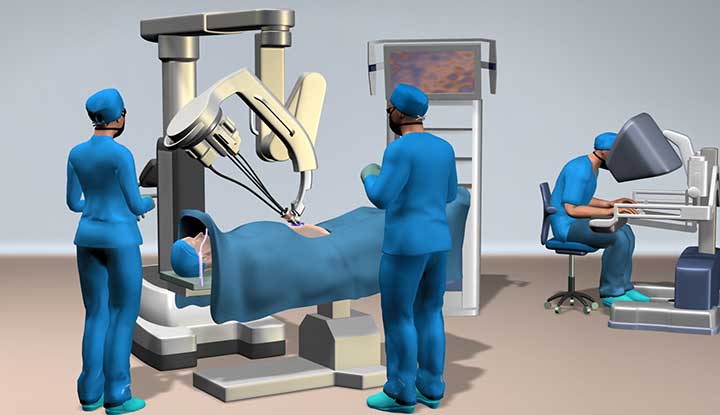 单孔机器人手术示意图