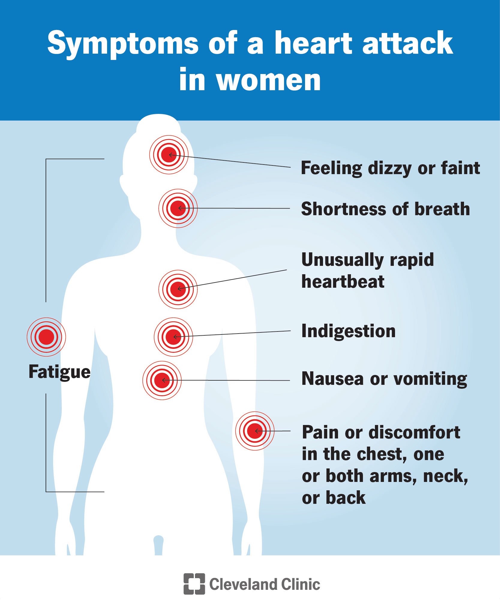 女性心脏病发作的症状包括恶心、疲劳、心跳加快等。
