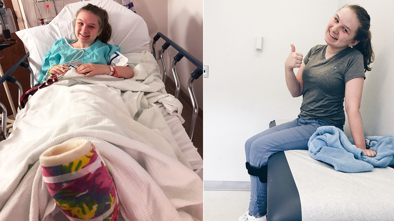 艾琳·布莱克在克利夫兰诊所接受了两次足部重建，第一次是在2017年8月，第二次是在2018年6月。(图片来源:Erin Black)
