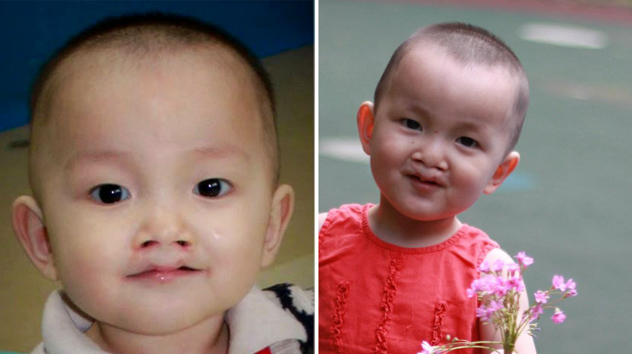 在被丽莎和斯科特·古德森收养之前，艾玛在中国的一家孤儿院。(提供:Lisa Goodson)
