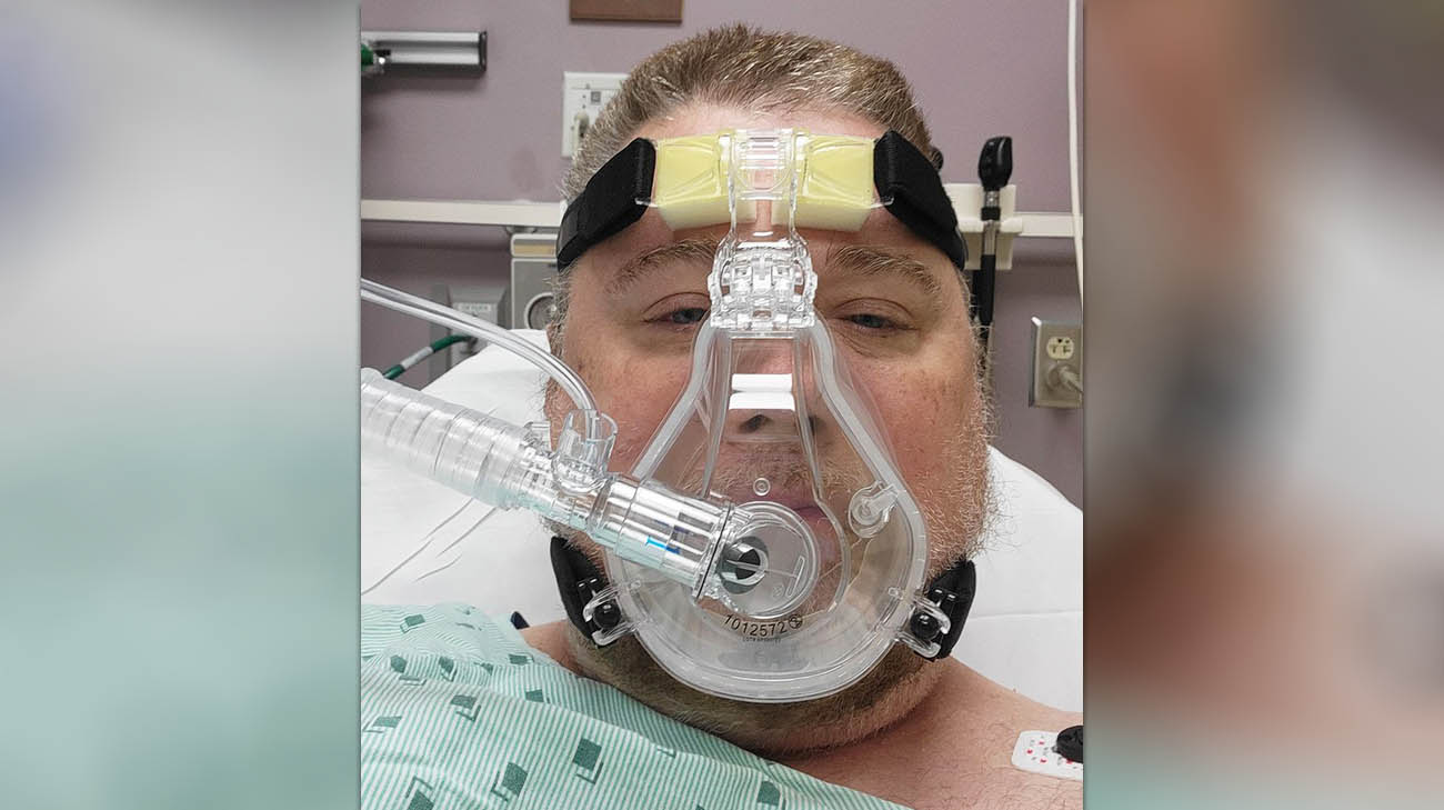在被诊断出COVID-19后，鲍勃在使用呼吸机之前使用了CPAP。