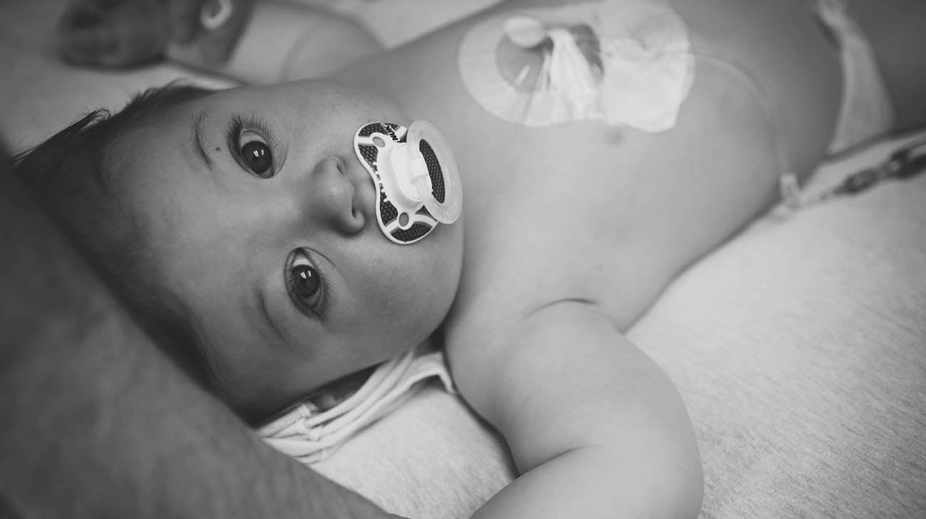 出生三个月后，亨德里克斯被诊断出患有亨特综合征，这是一种罕见的遗传疾病，主要影响男孩。
