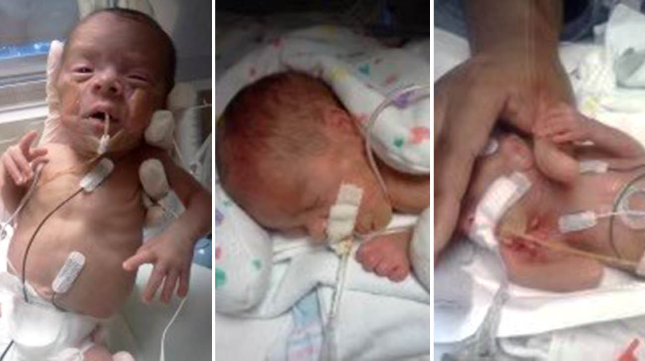 昆汀在克利夫兰希尔克雷斯特医院的新生儿重症监护室住了98天。