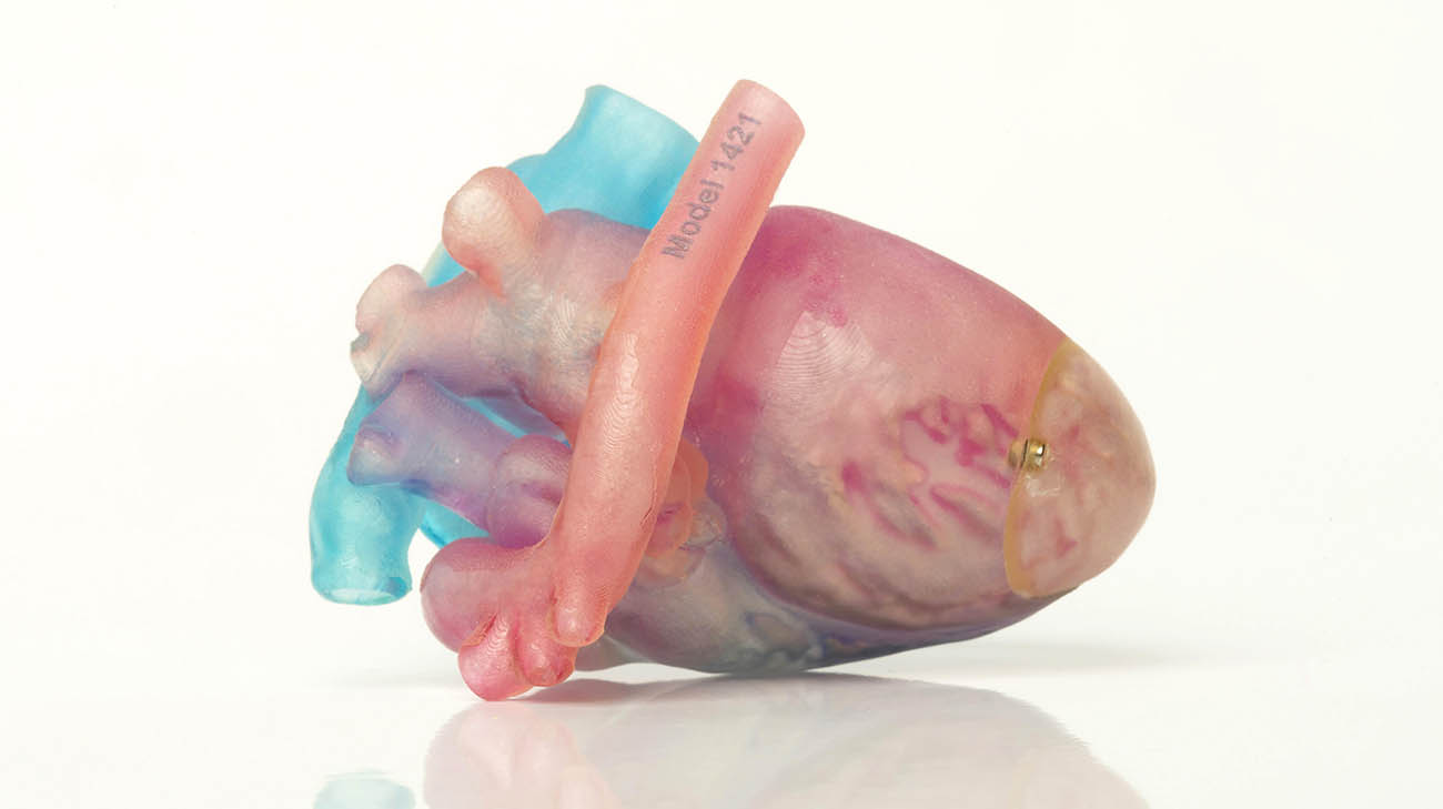 DJ Edmonds的心脏3d打印模型，在进行DJ心脏手术前指导哈尼·纳姆医生。
