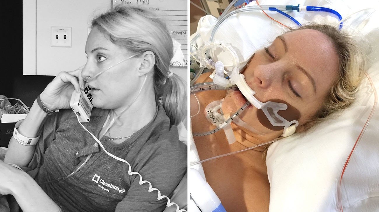 凯蒂·格雷戈里在克利夫兰诊所接受双肺移植手术前后的对比。
