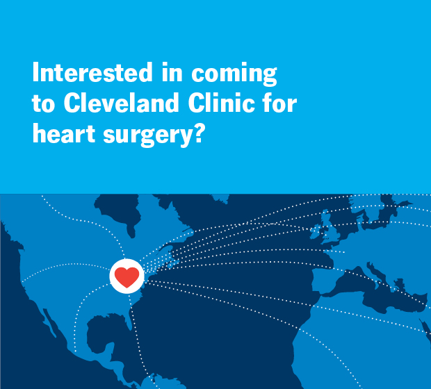 有兴趣来克利夫兰诊所做心脏手术吗?