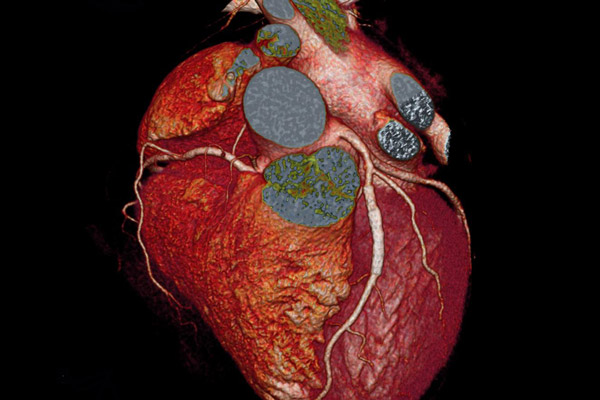 心血管成像研究，克利夫兰诊所